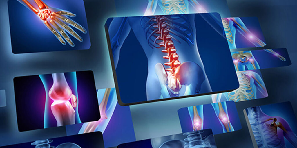 Νέα Δεδομένα για την ασφάλεια της υδροξυχλωροκίνης στη διαχείριση της Ρ. Αρθρίτιδας και του Σ.Ε.Λύκου