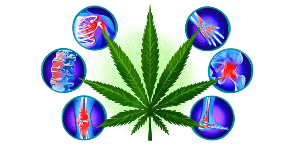 Διημερίδα στο Νοσοκομείο Παπαγεωργίου: «Κάνναβη & Επεμβατικές Τεχνικές στο Χρόνιο Πόνο – Ποιο θα είναι το επόμενο βήμα;»