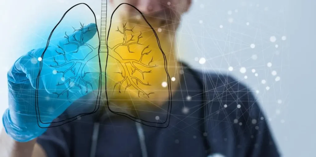 «Όλοι έχουμε Πνευμόνια! Πνευμονολόγο;»: Εκστρατεία ενημέρωσης και ευαισθητοποίησης της Ελληνικής Πνευμονολογικής Εταιρείας «Όλοι έχουμε Πνευμόνια! Πνευμονολόγο;»: Εκστρατεία ενημέρωσης και ευαισθητοποίησης της Ελληνικής Πνευμονολογικής Εταιρείας