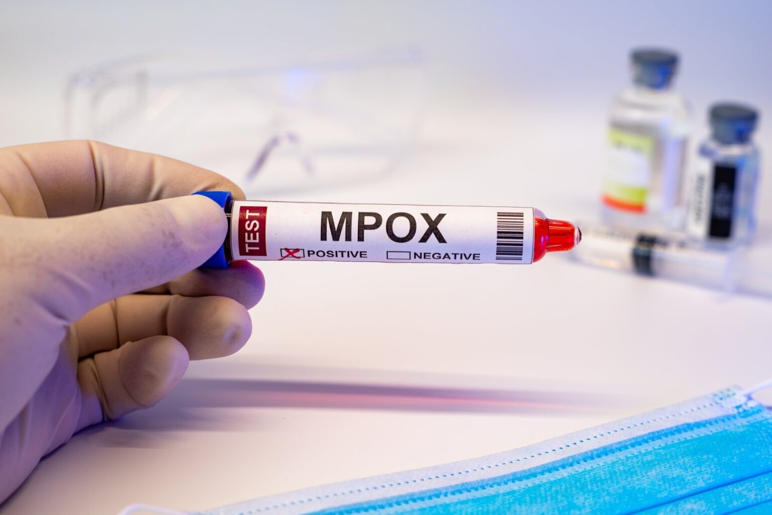 Δεύτερος θάνατος από τον ιό mpox αυτήν την εβδομάδα στη Ν. Αφρική