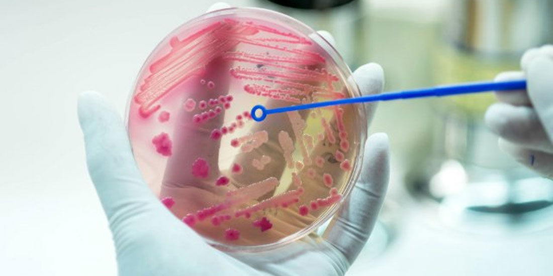 Ένας στους πέντε θανάτους κάθε χρόνο παγκοσμίως σχετίζονται με τη σήψη