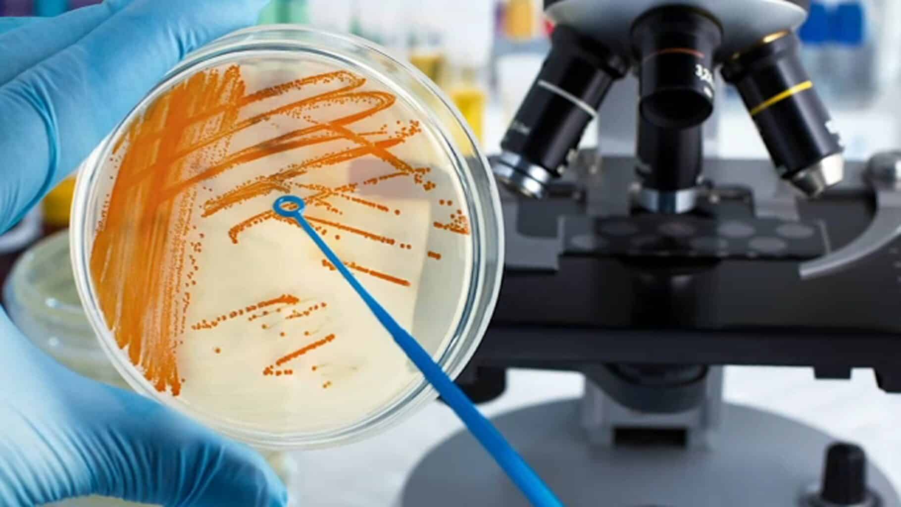 Ενημέρωση ΕΟΔΥ για τα περιστατικά λοίμωξης από διεισδυτικό στρεπτόκοκκο ομάδας Α (iGAS) dieisthitikos-streptokokkos-A-EODY