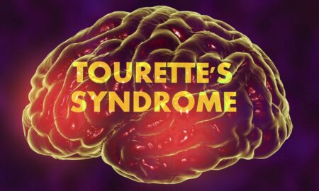 TOURETTE