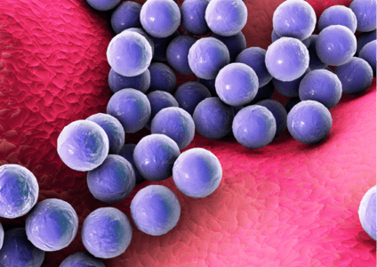 Staphylococcus-aureus