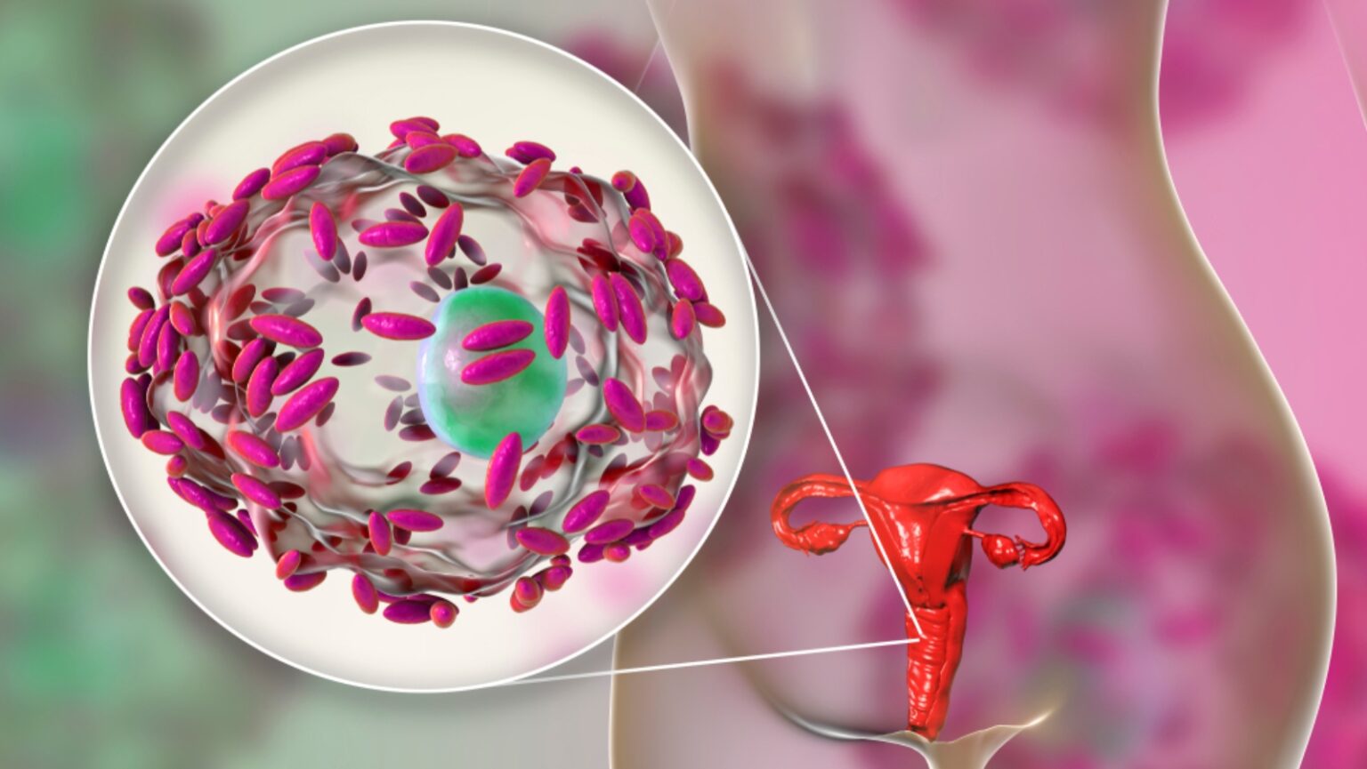 vaktiriaki-kolpitida-