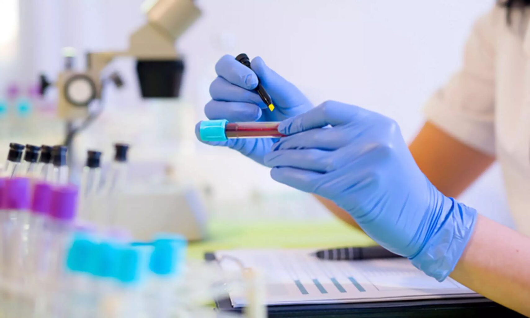 αιματολογικές-εξετάσεις