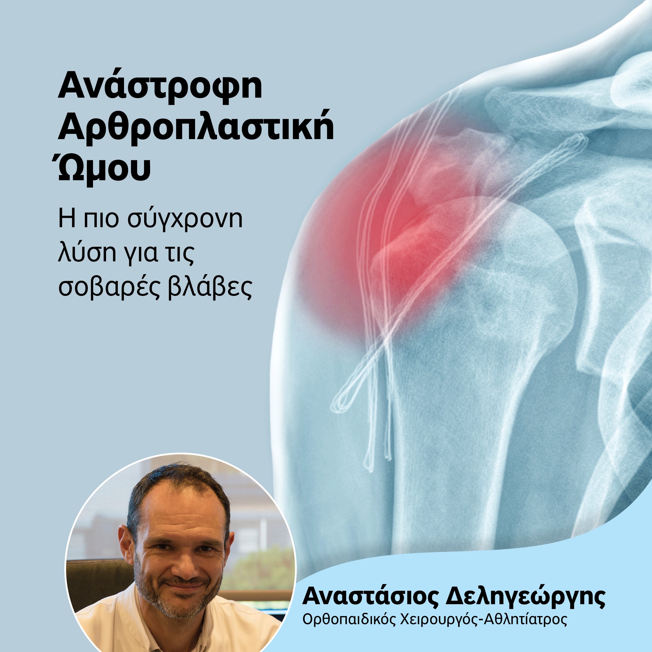 αρθροπλαστικής ώμου