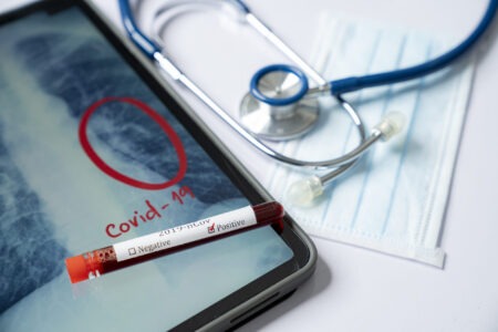 Αναστολείς-JAK-Ανάρρωση-Σοβαρή-COVID