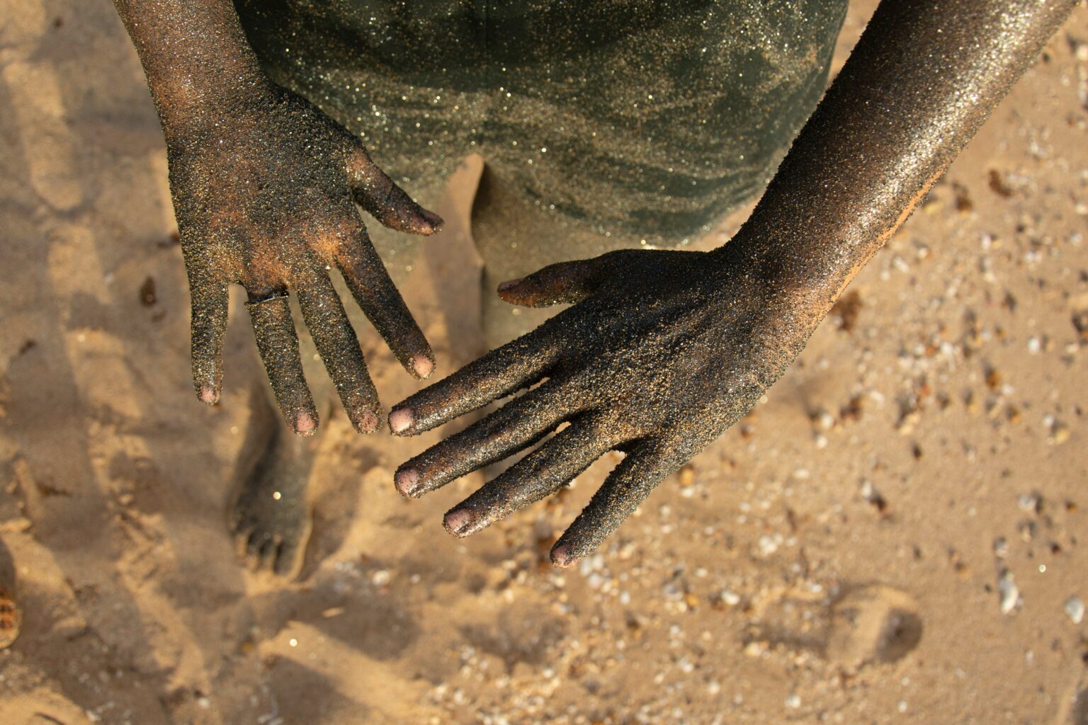 Σουδάν-172-νεκροί-από-χολέρα-σε-μία-εβδομάδα