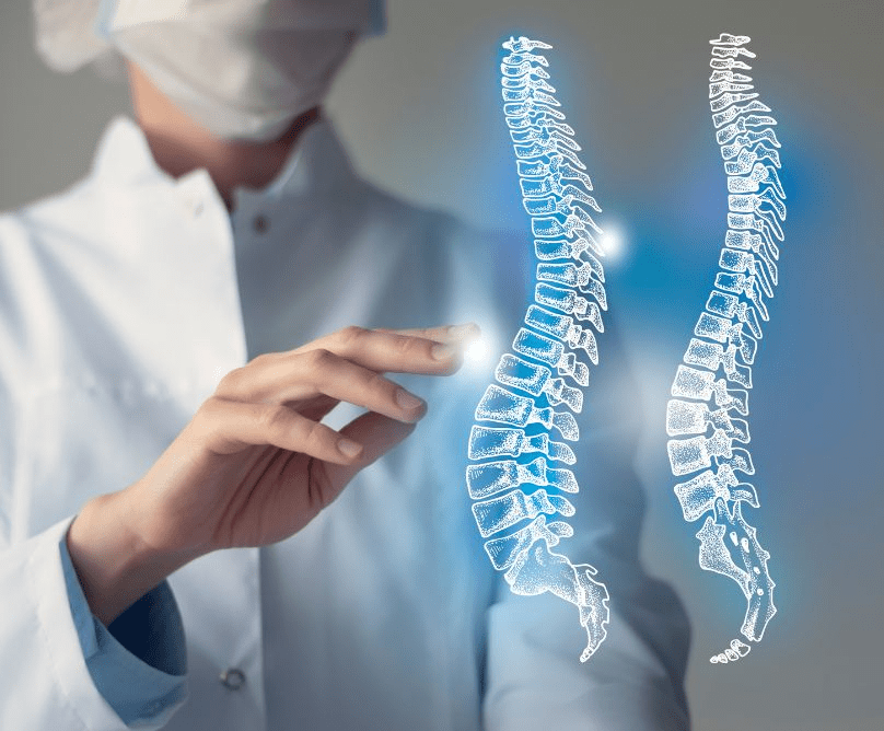 Αντιμετώπιση εφηβικής σκολίωσης με χειρουργική πλοήγηση σκολίωση