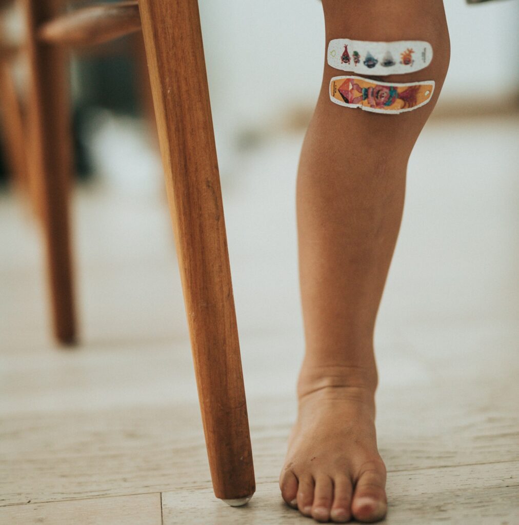 χωλότητα παιδιά