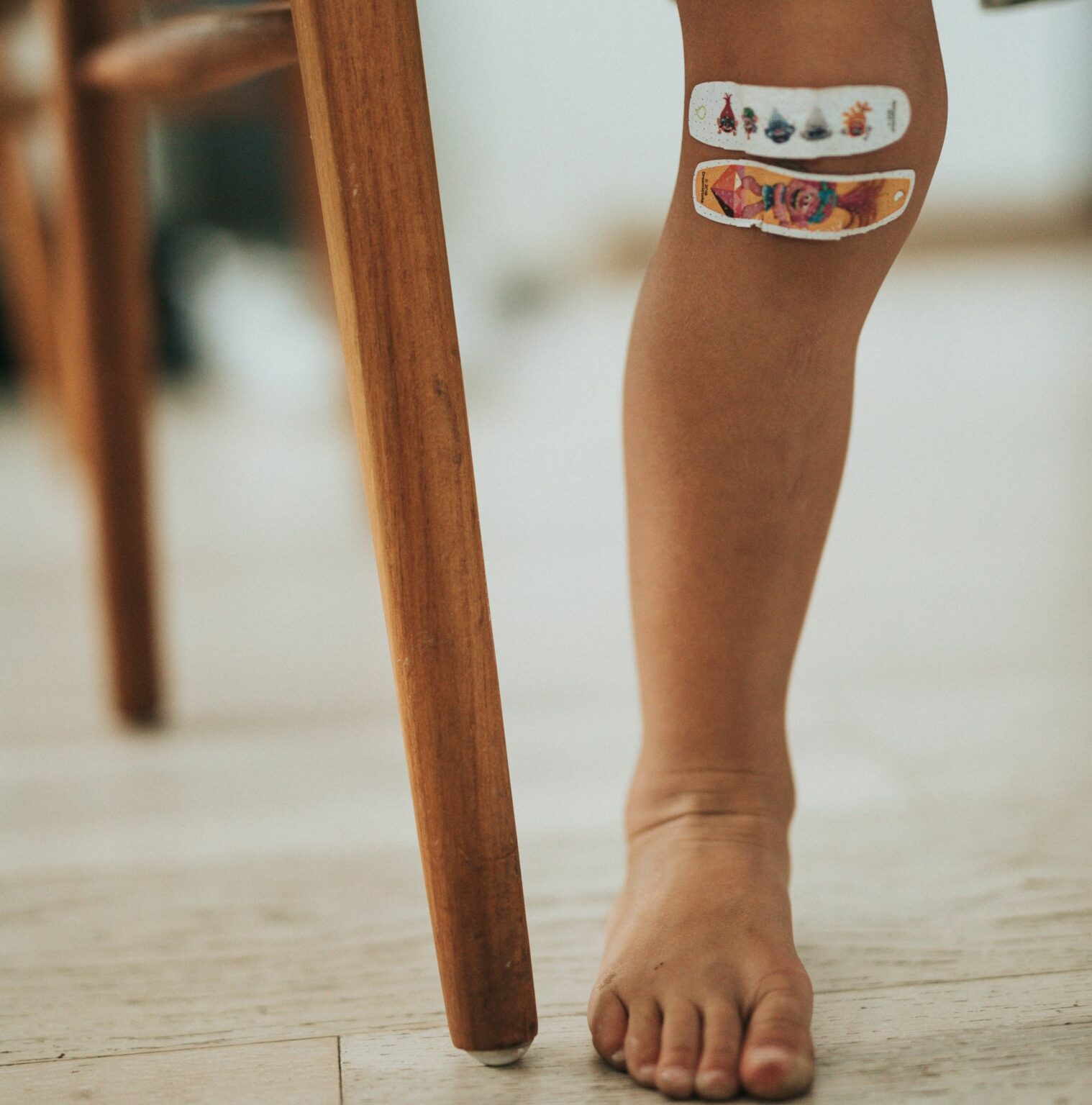 χωλότητα παιδιά