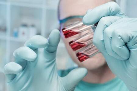 pollapli sklirynsi-exetasi-aimatos-