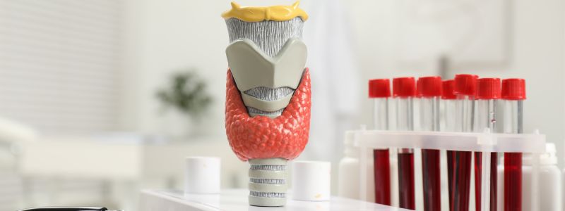 Υποθυρεοειδισμός: Πώς επηρεάζει τη ζωή σου – Τα “μην” της διατροφής