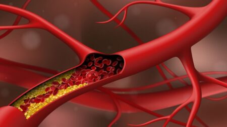 Αντιμετώπιση-υψηλής-χοληστερόλης-Προτάσεις-της-Ελληνικής-Καρδιολογικής-Εταιρείας