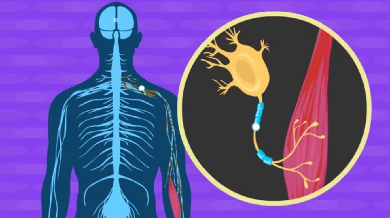 Νωτιαία Μυϊκή Ατροφία (SMA): Νέα έγκριση για σχήμα υψηλής δόσης – Τι αλλάζει για τους ασθενείς Νωτιαία Μυϊκή Ατροφία