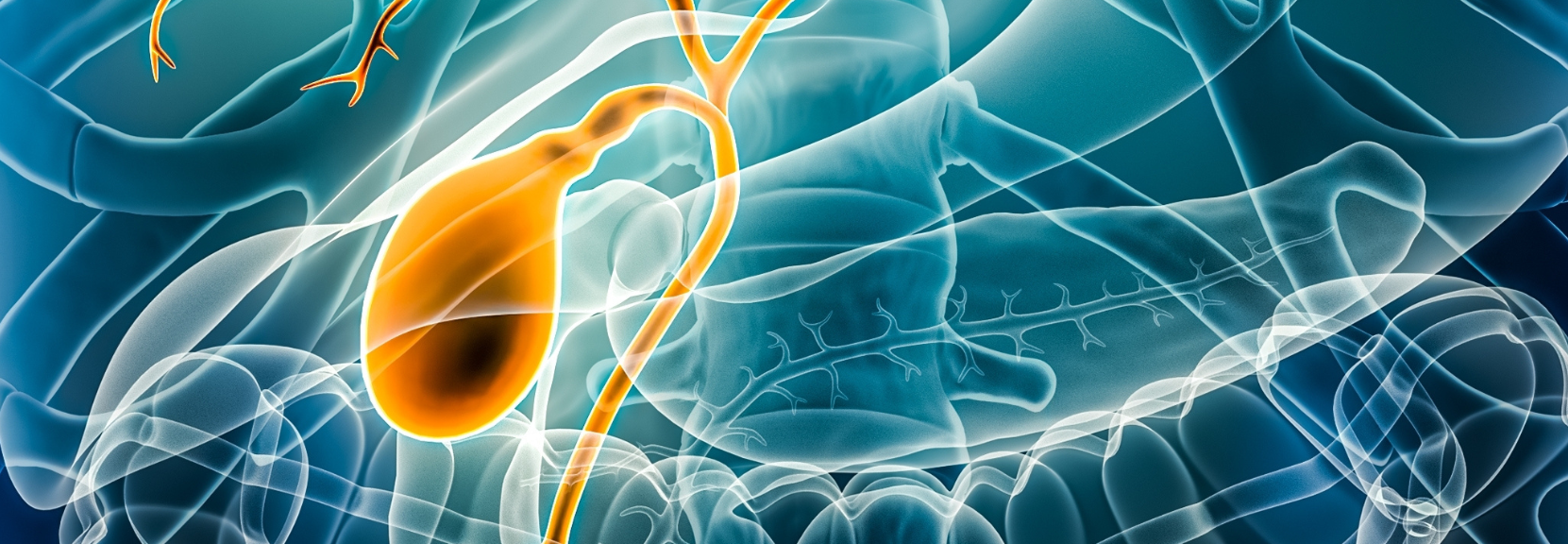 Χοληδόχος Κύστη και Πολύποδες: Διάγνωση και θεραπεία πολύποδες χοληδόχου κύστης