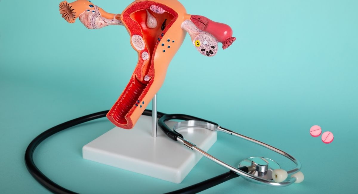 Ελπίδες για την ενδομητρίωση: Το «πράσινο φως» του FDA για μια πρωτοποριακή, μη ορμονική θεραπεία ενδομητρίωση νέο φάρμακο